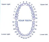 Tooth #19 extracted | Dental Phobia Forum