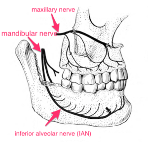 Can't get numb? What to do if dental injections don't work